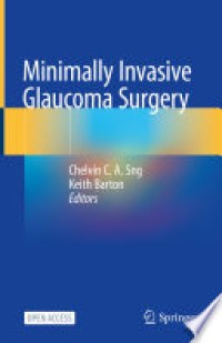 Minimally invasive glaucoma surgery : a practical guide